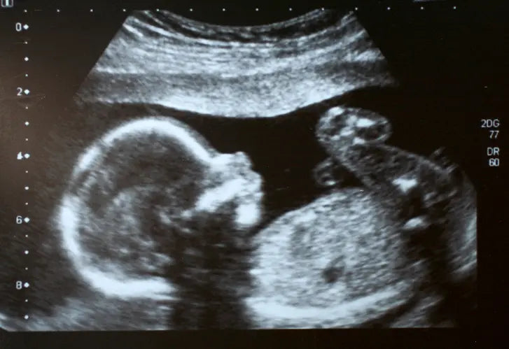 Échographie fille ou garçon : comment savoir ?